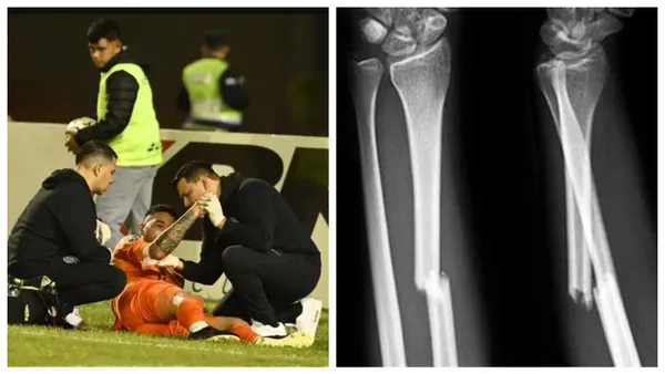 El arquero uruguayo viene recuperándose de su fractura en el antebrazo.